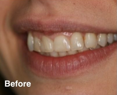 dentist in mexico prices dentist in mexico prices