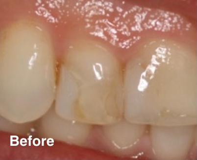dentist in mexico prices dentist in mexico prices