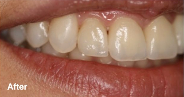 dentist in mexico prices dentist in mexico prices