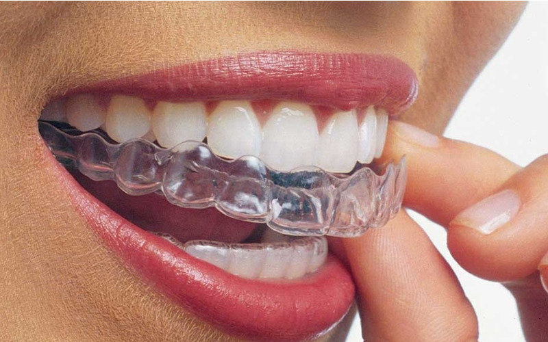 how to get dental work in mexico how to get dental work in mexico